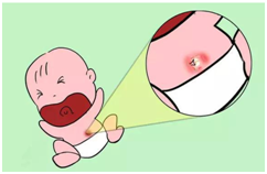 blob.png