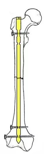 640.webp.jpg
