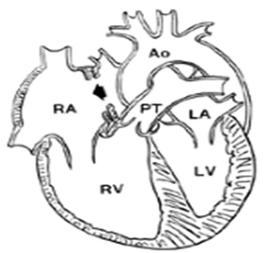 1553430602692626.jpg 640.webp.jpg