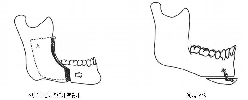 640 (1).png