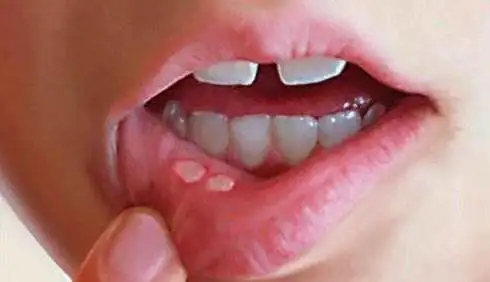 640.webp.jpg