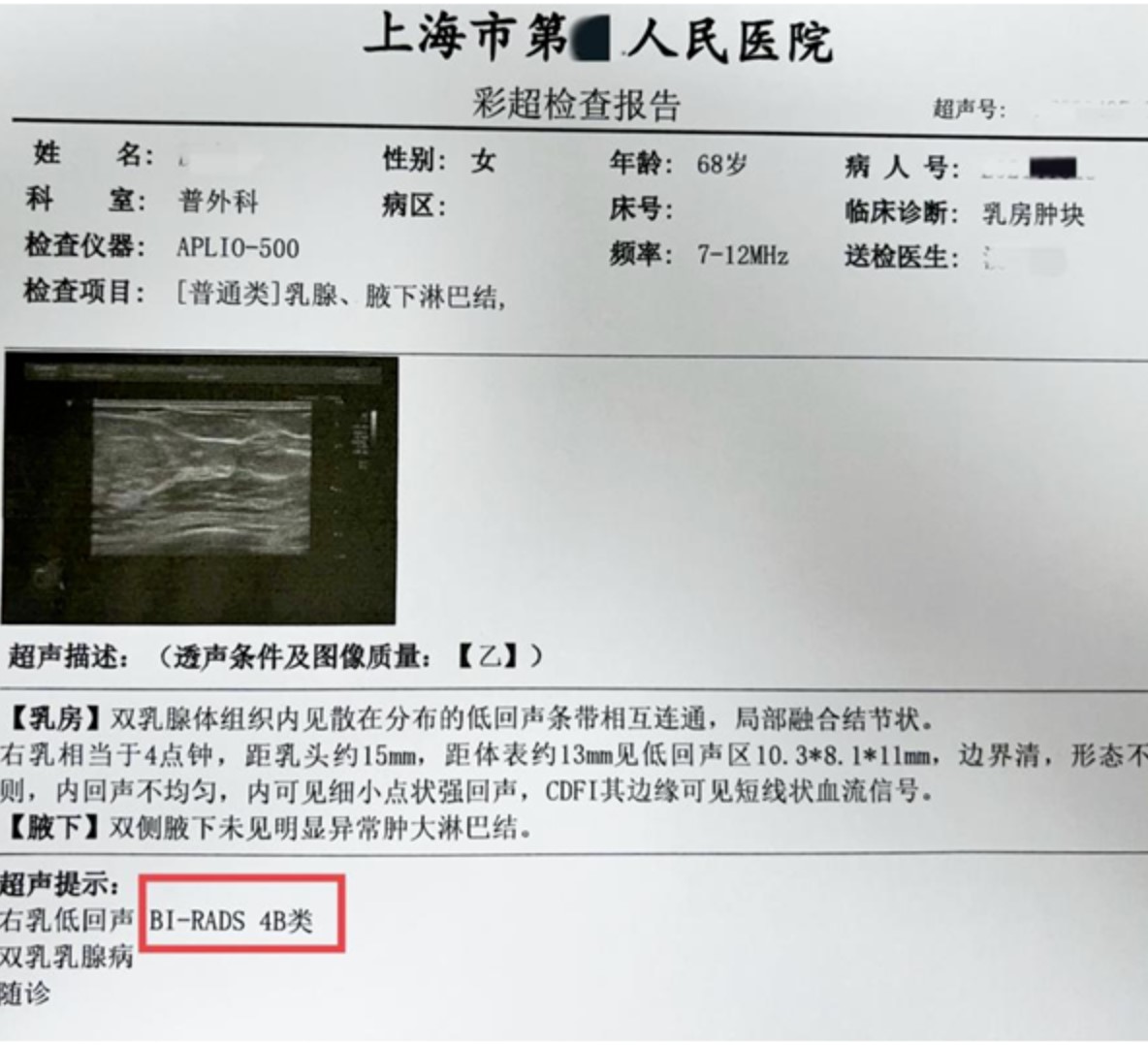 妇科做b超都查什么？-京东健康