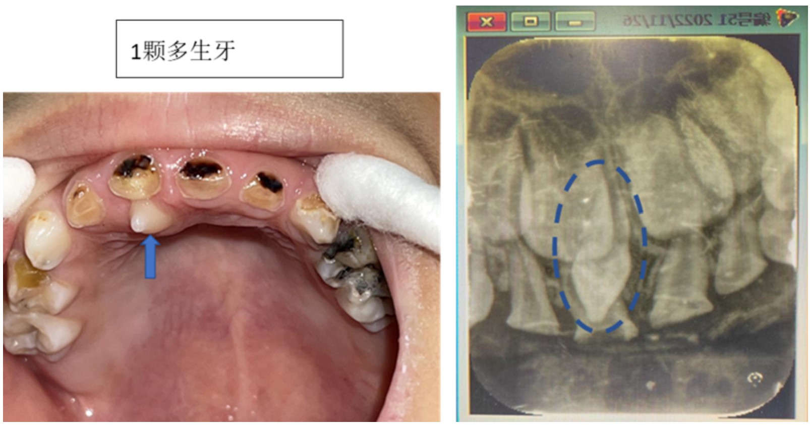 屏幕截图 2023-05-16 130116.jpg
