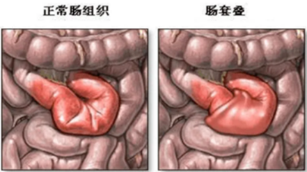1701748564196438.png 图片7.png
