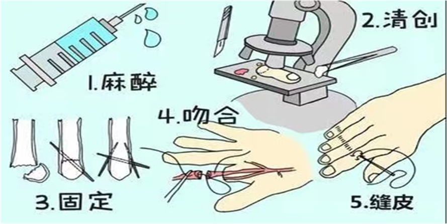 1701748845633204.png 图片11.png