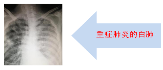 图片32.png